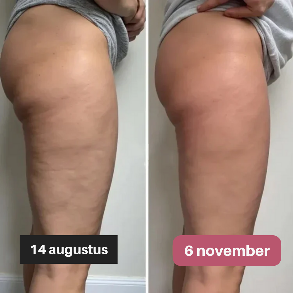 Slimaya 3D Legging | Nr.1 tegen Cellulite & Vetverbrandingseffect