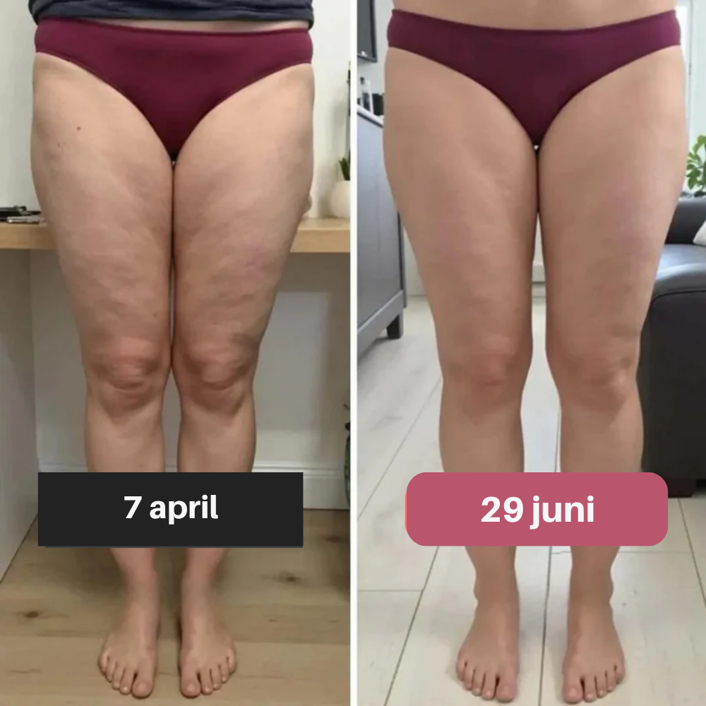 Slimaya 3D Legging | Nr.1 tegen Cellulite & Vetverbrandingseffect