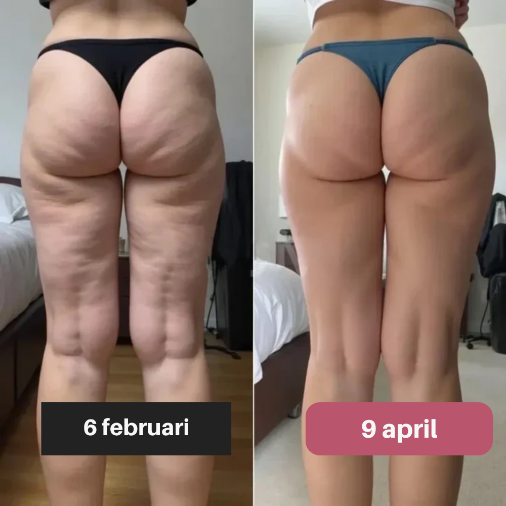 Slimaya 3D Legging | Nr.1 tegen Cellulite & Vetverbrandingseffect