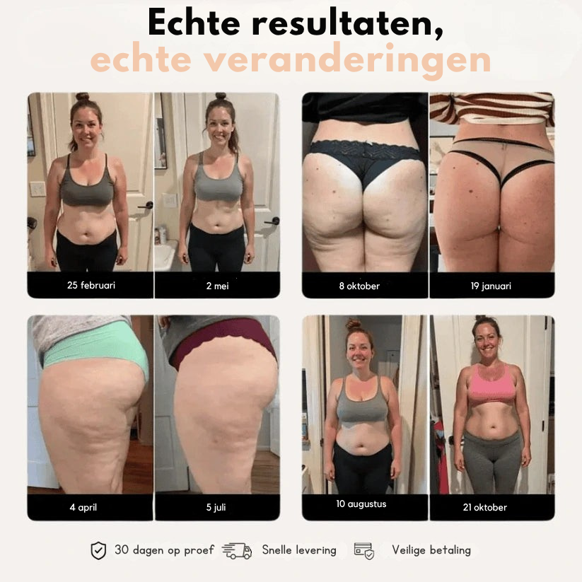 Slimaya 3D Legging | Nr.1 tegen Cellulite & Vetverbrandingseffect